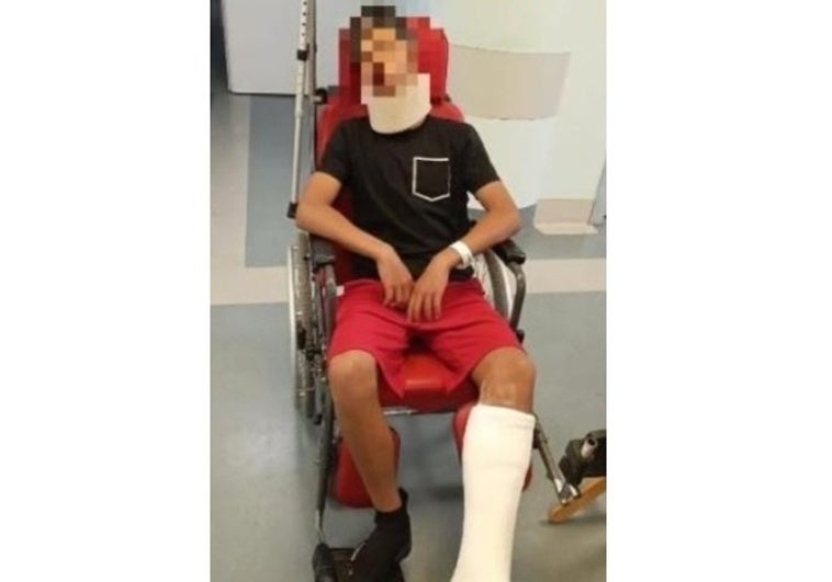 Un niño de 13 años, hospitalizado tras la salvaje agresión del padre de un jugador rival