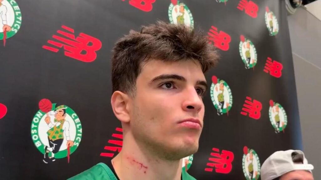 Hugo González comparece con arañazos en el cuello: “Estuve peleando ahí fuera”