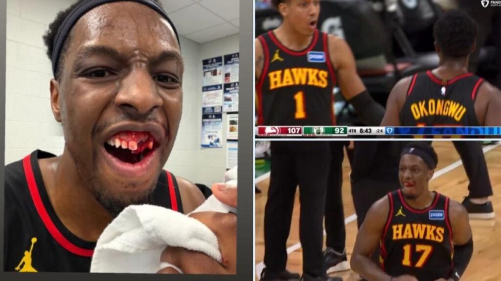"¿Conocen a un buen dentista?": La brutal imagen de Okongwu tras perder varios dientes por un codazo de Jaylen Brown